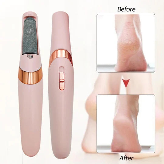 Beautique™ Callus Remover